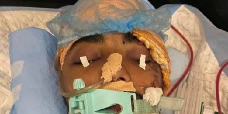 सवारी दुर्घटनामा घाइते रिवाज पौडेलको जीवन बचाई दिन परिवारद्धारा याचना